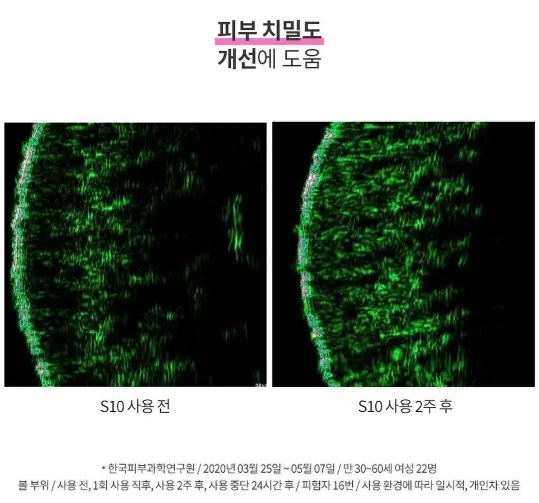 thumbnail-11